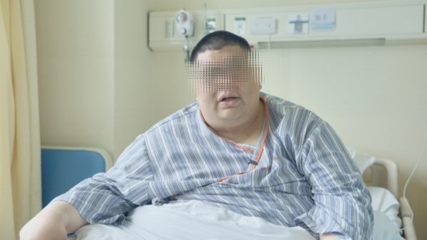 2026世界杯官方网站 ​“沪上第一胖”在上海新华病院微创术后半月减重近40斤